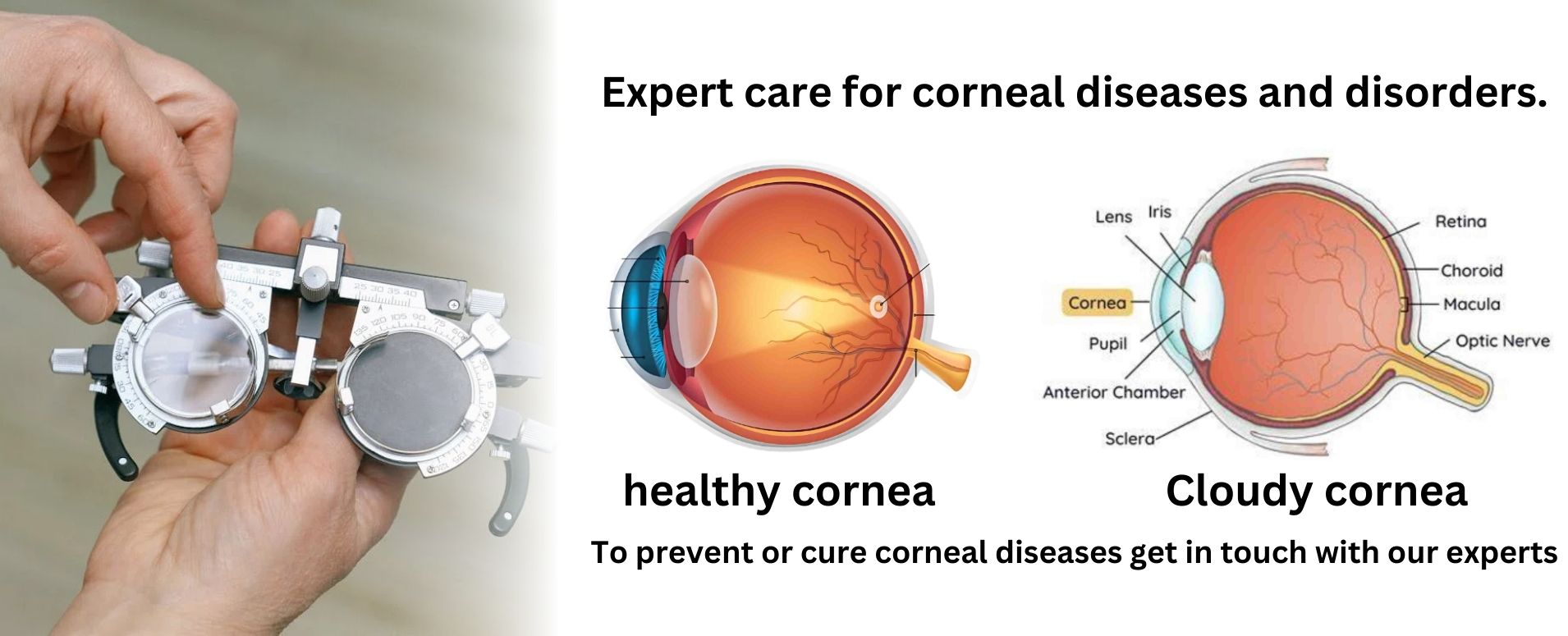 cornea-treatment